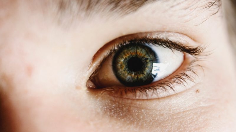 Jak získat pojištění k zaplacení operace očních víček? 3 nejvyšší podmínky!