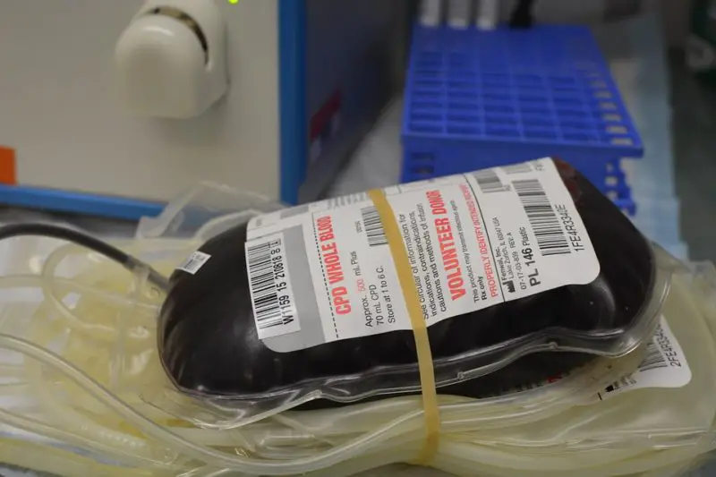 Co je autologní dárcovství krve? Jeho 3 úžasné metody!